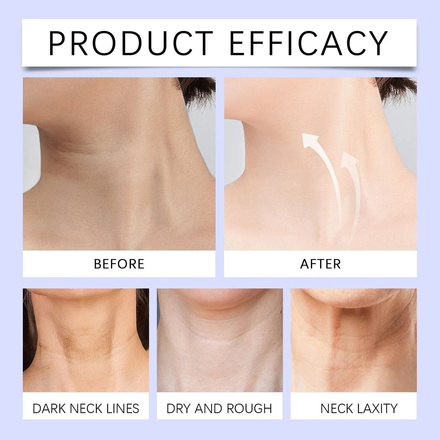 Neck Cream-Tighten & LiftFirming Neck Cream for Crepey Skin 1.7fl oz(50ml)